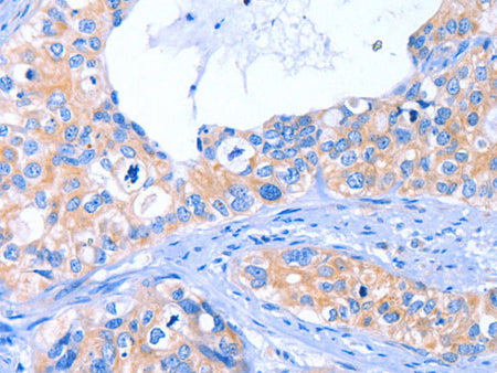 ARRB1 Polyclonal Antibody Store at -20°C