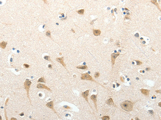 SEMA3D Polyclonal Antibody Store at -20°C