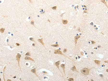 SEMA3D Polyclonal Antibody Store at -20°C