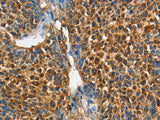 ADCY4 Polyclonal Antibody