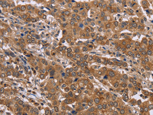 FAAH2 Polyclonal Antibody Store at -20°C