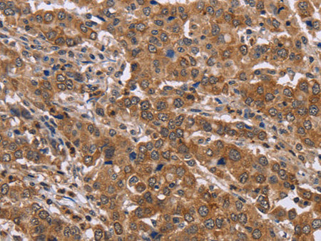 FAAH2 Polyclonal Antibody Store at -20°C