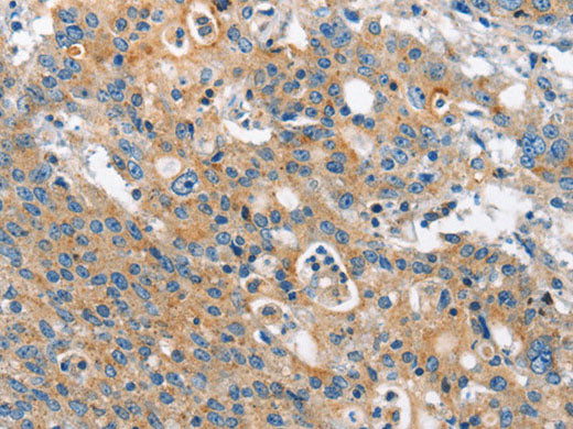 CHMP1A Polyclonal Antibody Store at -20°C