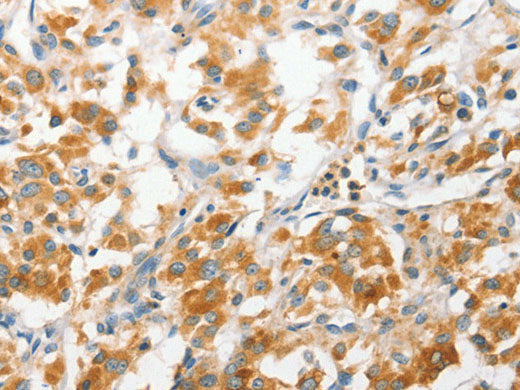 ANAPC2 Polyclonal Antibody Store at -20°C