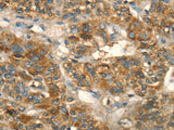 HSD17B8 Polyclonal Antibody Store at -20°C