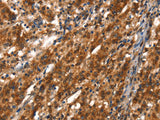 CYP2D6 Polyclonal Antibody Store at -20°C