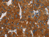 CARD9 Polyclonal Antibody Store at -20°C