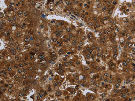 FASTKD1 Polyclonal Antibody Store at -20°C