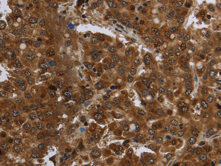 FASTKD1 Polyclonal Antibody Store at -20°C