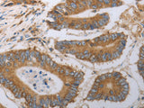SLC22A6 Polyclonal Antibody