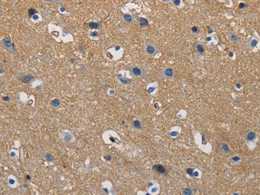 GSTA2 Polyclonal Antibody Store at -20°C