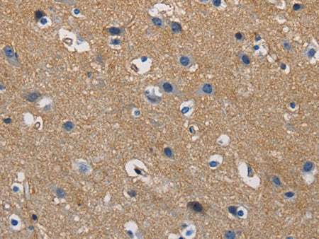 GSTA2 Polyclonal Antibody Store at -20°C