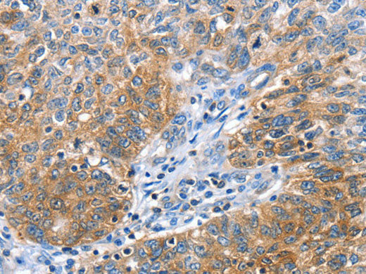 CGB Polyclonal Antibody Store at -20°C