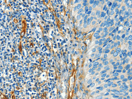 DIO2 Polyclonal Antibody