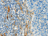 DIO2 Polyclonal Antibody