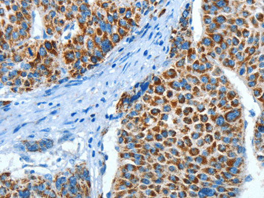 ALDH4A1 Polyclonal Antibody Store at -20°C