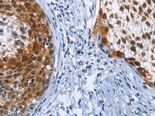 CRABP2 Polyclonal Antibody Store at -20°C