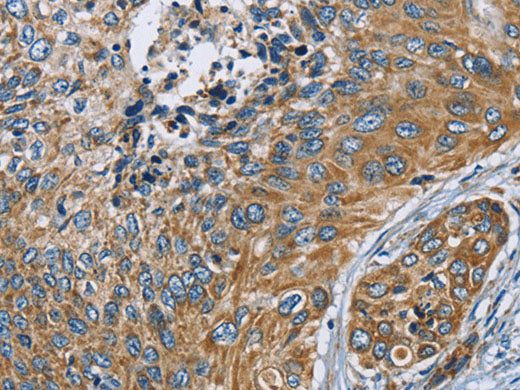 ZMYND11 Polyclonal Antibody