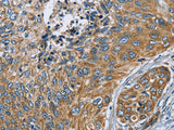 ZMYND11 Polyclonal Antibody