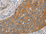 Crystallin-alpha C Polyclonal Antibody