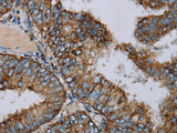 NDUFA9 Polyclonal Antibody Reactivity Human