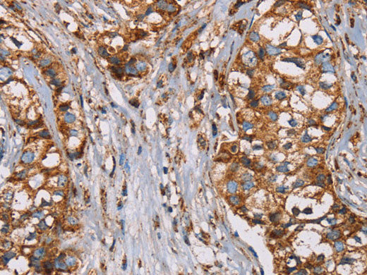 NDUFS1 Polyclonal Antibody Store at -20°C