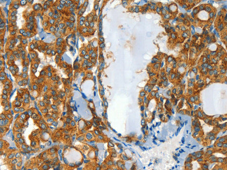 CLPTM1L Polyclonal Antibody Store at -20°C
