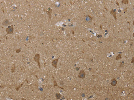 PTK2B Polyclonal Antibody Store at -20°C