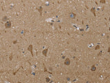 PTK2B Polyclonal Antibody Store at -20°C