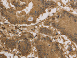 KDM5B Polyclonal Antibody