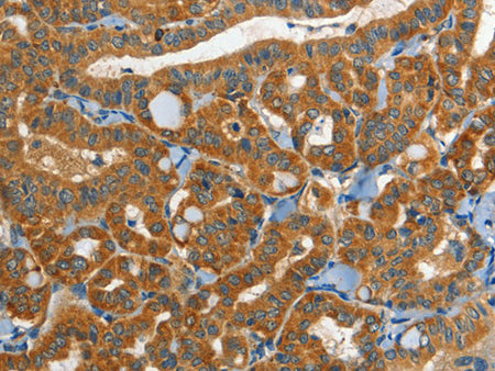 EPHB3 Polyclonal Antibody Store at -20°C