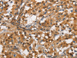 CD13 Polyclonal Antibody Store at -20°C