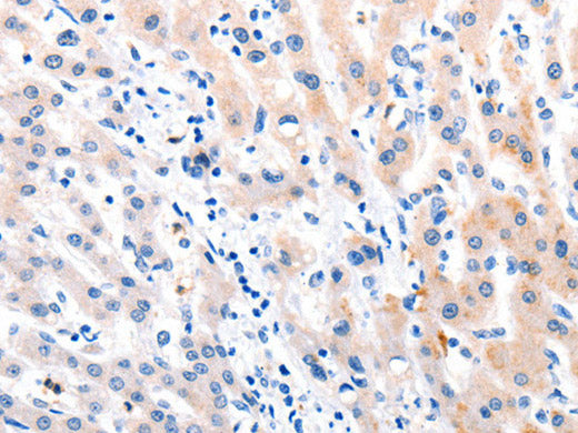 MTOR Polyclonal Antibody Store at -20°C