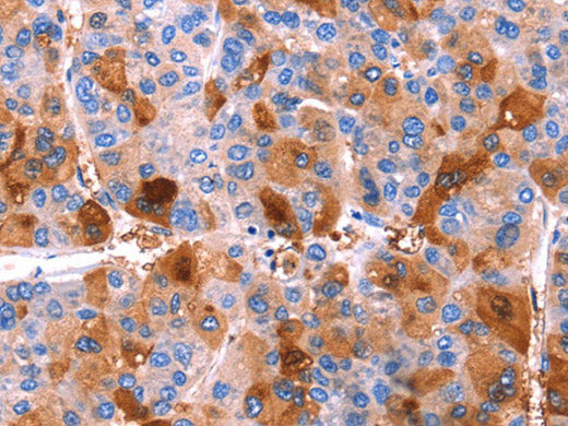 ERN2 Polyclonal Antibody Store at -20°C