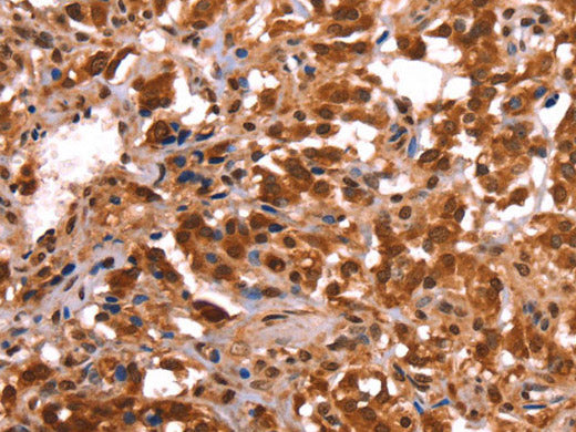 ESRRB Polyclonal Antibody Store at -20°C
