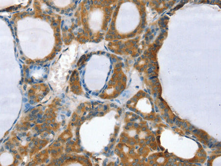 PPP2CA Polyclonal Antibody Store at -20°C