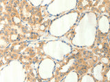 TRPM5 Polyclonal Antibody Store at -20°C
