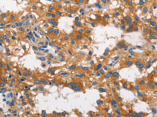 CLTC Polyclonal Antibody Store at -20°C