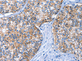 CD239 Polyclonal Antibody