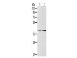 PDGFRL Polyclonal Antibody