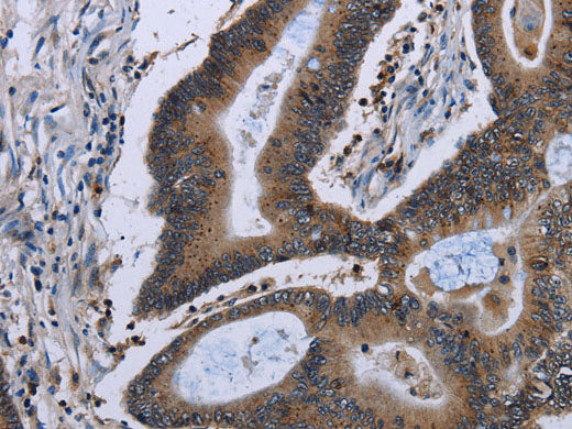 ITGAE Polyclonal Antibody Store at -20°C