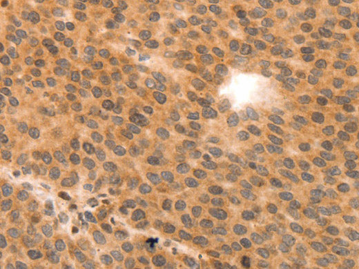 MYL9 Polyclonal Antibody Store at -20°C