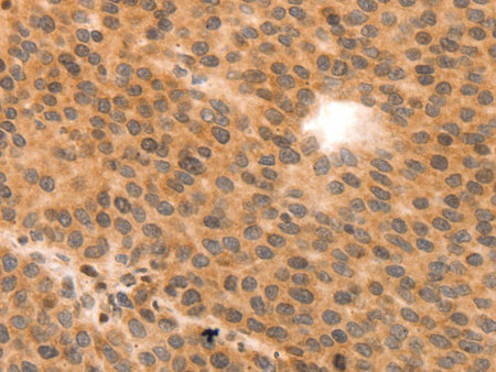 MYL9 Polyclonal Antibody Store at -20°C