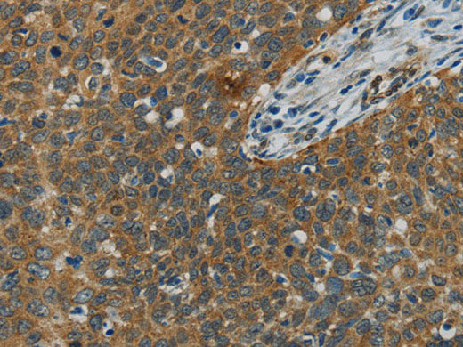 E2F6 Polyclonal Antibody