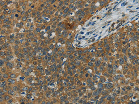 E2F6 Polyclonal Antibody
