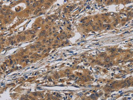 INPPL1 Polyclonal Antibody Store at -20°C