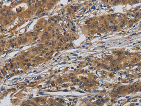 INPPL1 Polyclonal Antibody Store at -20°C