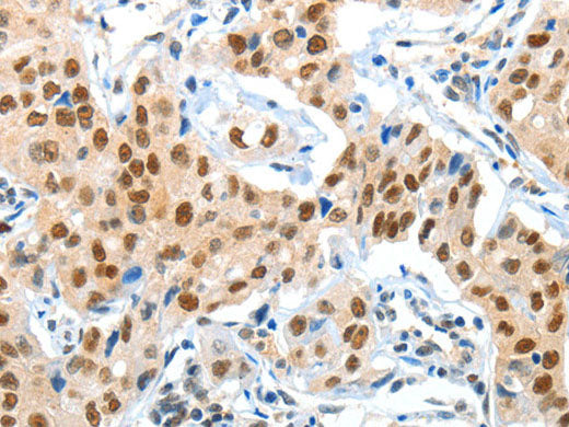 APPL1 Polyclonal Antibody Store at -20°C