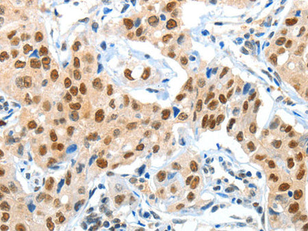 APPL1 Polyclonal Antibody Store at -20°C