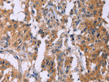 CMTM6 Polyclonal Antibody Store at -20°C